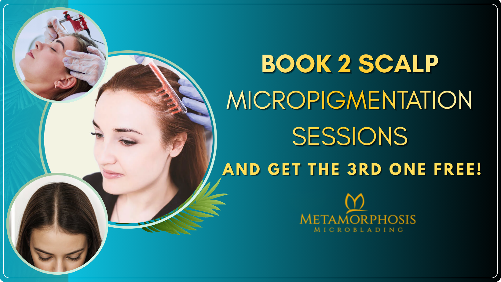 scalp micropigmentation